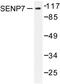 SUMO Specific Peptidase 7 antibody, AP06461PU-N, Origene, Western Blot image 