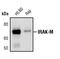 Interleukin 1 Receptor Associated Kinase 3 antibody, PA5-17473, Invitrogen Antibodies, Western Blot image 
