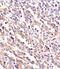 Transforming Growth Factor Beta Receptor 2 antibody, 56-081, ProSci, Immunohistochemistry frozen image 