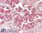 Major Histocompatibility Complex, Class II, DQ Alpha 2 antibody, 42-669, ProSci, Enzyme Linked Immunosorbent Assay image 