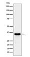 Proteasome 26S Subunit, Non-ATPase 14 antibody, M06584, Boster Biological Technology, Western Blot image 