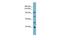 RB Binding Protein 6, Ubiquitin Ligase antibody, PA5-42292, Invitrogen Antibodies, Western Blot image 