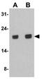 Serine And Arginine Rich Splicing Factor 3 antibody, GTX31947, GeneTex, Western Blot image 
