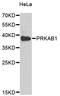 Protein Kinase AMP-Activated Non-Catalytic Subunit Beta 1 antibody, LS-C333008, Lifespan Biosciences, Western Blot image 