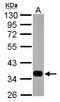 Sodium/potassium-transporting ATPase subunit beta-1 antibody, LS-C155761, Lifespan Biosciences, Western Blot image 