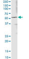Aldehyde Dehydrogenase 3 Family Member A1 antibody, LS-C196640, Lifespan Biosciences, Immunoprecipitation image 