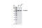 Catenin Beta 1 antibody, 9581S, Cell Signaling Technology, Western Blot image 