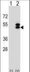 Ataxin 3 antibody, LS-C156684, Lifespan Biosciences, Western Blot image 