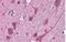 Signal Transducing Adaptor Family Member 2 antibody, NB300-987, Novus Biologicals, Immunohistochemistry paraffin image 