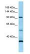 Receptor Tyrosine Kinase Like Orphan Receptor 1 antibody, NBP1-98395, Novus Biologicals, Western Blot image 