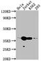 Cyclin Dependent Kinase 6 antibody, CSB-RA555745A0HU, Cusabio, Western Blot image 