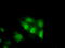 Tetratricopeptide Repeat Domain 32 antibody, TA501337, Origene, Immunofluorescence image 