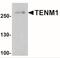 Teneurin Transmembrane Protein 1 antibody, NBP2-41315, Novus Biologicals, Western Blot image 