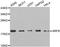 ADP Ribosylation Factor 6 antibody, A3162, ABclonal Technology, Western Blot image 