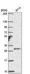 Testis Specific Serine Kinase 4 antibody, NBP2-56284, Novus Biologicals, Western Blot image 