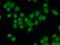 Heterogeneous Nuclear Ribonucleoprotein U antibody, 16365-1-AP, Proteintech Group, Immunofluorescence image 