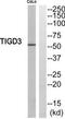 Tigger Transposable Element Derived 3 antibody, TA316249, Origene, Western Blot image 