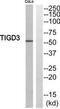 Tigger transposable element-derived protein 3 antibody, TA316249, Origene, Western Blot image 