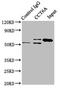 Chaperonin Containing TCP1 Subunit 6A antibody, LS-C375404, Lifespan Biosciences, Immunoprecipitation image 