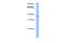 Sprouty RTK Signaling Antagonist 2 antibody, A02089, Boster Biological Technology, Western Blot image 