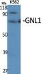 G Protein Nucleolar 1 (Putative) antibody, A09923, Boster Biological Technology, Western Blot image 