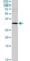 MAD2L1 Binding Protein antibody, H00009587-M03, Novus Biologicals, Western Blot image 