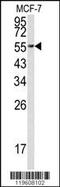 Eukaryotic Translation Elongation Factor 1 Alpha 1 antibody, MBS9205539, MyBioSource, Western Blot image 