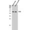 Transcription Factor EB antibody, LS-C386385, Lifespan Biosciences, Western Blot image 