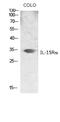 Interleukin 15 Receptor Subunit Alpha antibody, A03016, Boster Biological Technology, Western Blot image 