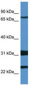 Potassium Voltage-Gated Channel Subfamily D Member 1 antibody, TA338547, Origene, Western Blot image 