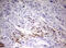 TIMELESS-interacting protein antibody, LS-C789740, Lifespan Biosciences, Immunohistochemistry paraffin image 