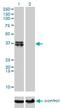 Beta-1,4-Galactosyltransferase 4 antibody, H00008702-M01, Novus Biologicals, Western Blot image 