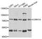 UTP4 Small Subunit Processome Component antibody, A8593, ABclonal Technology, Western Blot image 