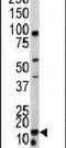 BAALC Binder Of MAP3K1 And KLF4 antibody, PA5-13554, Invitrogen Antibodies, Western Blot image 