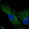 Transmembrane Protein 200C antibody, NBP2-30838, Novus Biologicals, Immunocytochemistry image 