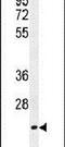 Transcription Elongation Factor A Like 3 antibody, PA5-24024, Invitrogen Antibodies, Western Blot image 