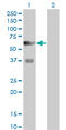 6-Phosphofructo-2-Kinase/Fructose-2,6-Biphosphatase 3 antibody, LS-C197884, Lifespan Biosciences, Western Blot image 