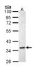 Inhibin Subunit Alpha antibody, NBP1-33030, Novus Biologicals, Western Blot image 