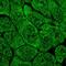 Multiple C2 And Transmembrane Domain Containing 2 antibody, HPA051176, Atlas Antibodies, Immunofluorescence image 