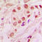 Parkinsonism Associated Deglycase antibody, LS-C353340, Lifespan Biosciences, Immunohistochemistry paraffin image 