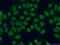 Small Nuclear Ribonucleoprotein Polypeptide F antibody, 14977-1-AP, Proteintech Group, Immunofluorescence image 