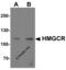 HMG-CoA reductase antibody, PM-7211, ProSci, Western Blot image 