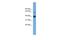 Transmembrane Protein 130 antibody, A15506, Boster Biological Technology, Western Blot image 