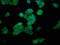 Myosin Heavy Chain 4 antibody, LS-C674029, Lifespan Biosciences, Immunofluorescence image 