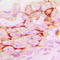 Matrix Metallopeptidase 14 antibody, LS-C352537, Lifespan Biosciences, Immunohistochemistry paraffin image 
