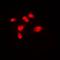 Sphingosine Kinase 1 antibody, orb382053, Biorbyt, Immunofluorescence image 