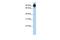 Regulator Of G Protein Signaling 3 antibody, GTX77726, GeneTex, Western Blot image 