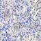 Protein Kinase C Beta antibody, A5845, ABclonal Technology, Immunohistochemistry paraffin image 