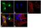 Calcium/Calmodulin Dependent Protein Kinase Kinase 1 antibody, PA1-542, Invitrogen Antibodies, Immunofluorescence image 