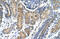 Snail Family Transcriptional Repressor 2 antibody, 27-822, ProSci, Enzyme Linked Immunosorbent Assay image 